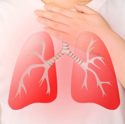 Bệnh viêm phổi là gì? Triệu chứng, nguyên nhân và cách điều trị